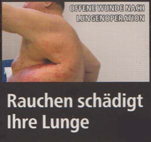 Rauchen schädigt Ihre Lunge