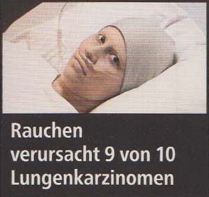 Rauchen verursacht 9 von 10 Lungenkarzinomen